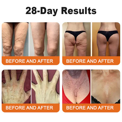 👨‍⚕️ Made and Shipped from USA✅ TLOPA™ Botox Bee Venom Wrinkle Removal Cream-✨28-Day Results✨ 🔥