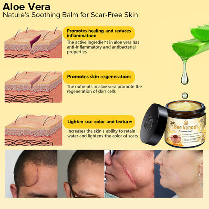 JORONDY™ Bee Venom Skin Treatment Cream（𝐴𝐴𝐷 𝑅𝑒𝑐𝑜𝑚𝑚𝑒𝑛𝑑𝑒𝑑）