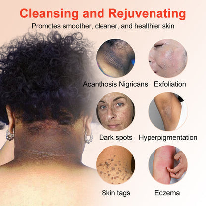 Deep Cleansing Exfoliating Gel🍎