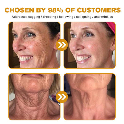 👨‍⚕️ Made and Shipped from USA✅ TLOPA™ Botox Bee Venom Wrinkle Removal Cream-✨28-Day Results✨ 🔥