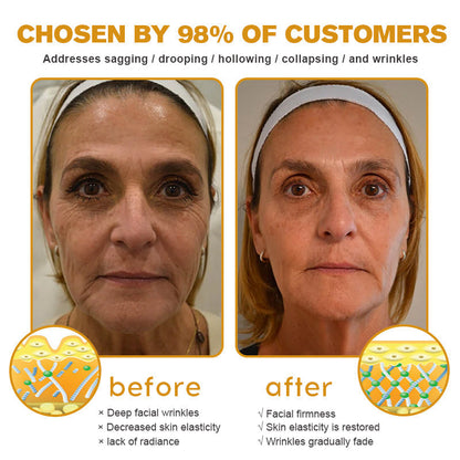 👨‍⚕️ Made and Shipped from USA✅ TLOPA™ Botox Bee Venom Wrinkle Removal Cream-✨28-Day Results✨ 🔥